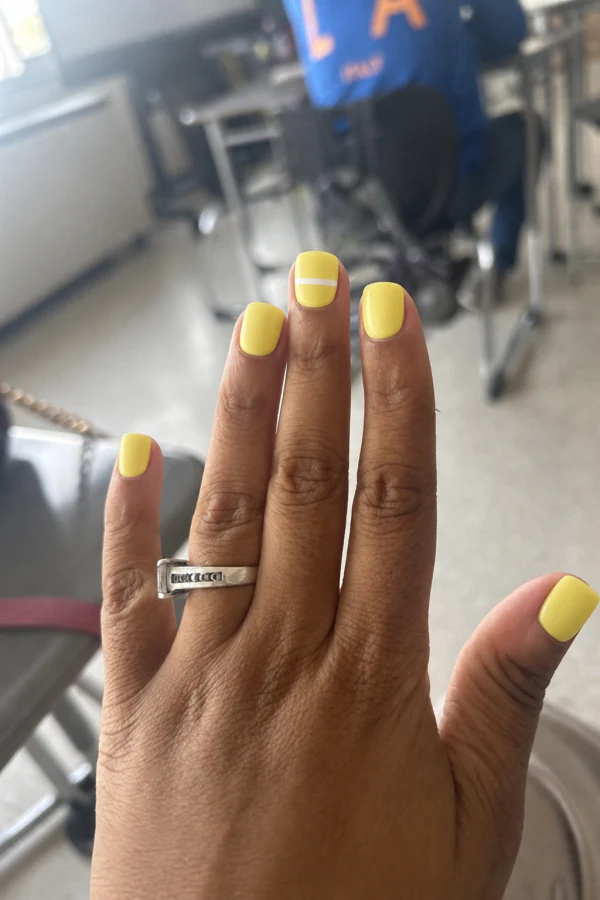 The yellow nail design interpreted on a different hand